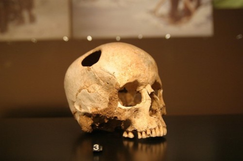 craniu