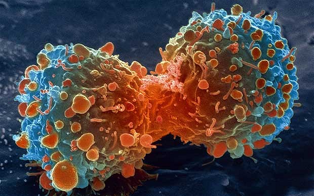 Un nou studiu ştiinţific arată încă o dată că dozele mari de vitamina C înving cancerul!