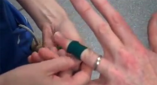 Vezi cum îți poţi scoate verigheta înţepenită de pe deget (video)
