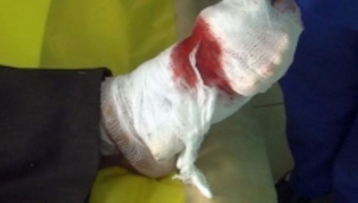 Și-a înfăşurat un ficat de porc în jurul piciorului şi a ieşit la cerşit