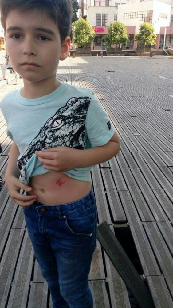 Copil rănit în „Groapa lui Gyuszi”. Ce s-a întâmplat (Foto)
