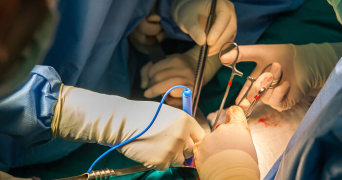 Românii își vând organele pentru bani