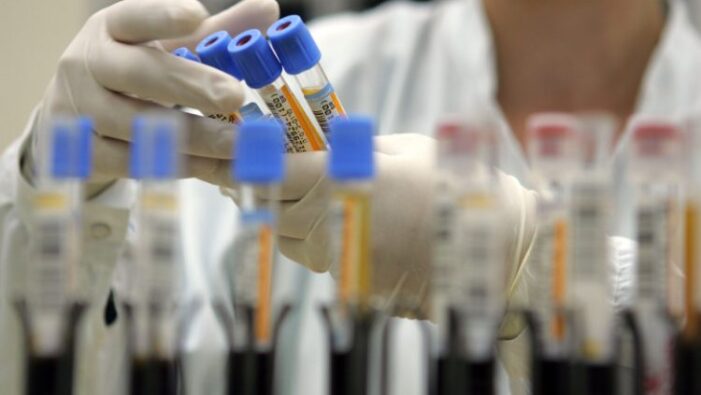 Un nou virus, stare de alertă în mai multe ţări din Europa