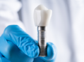 Cauți o soluție durabilă pentru dinții pierduți? Alege implanturile dentare!