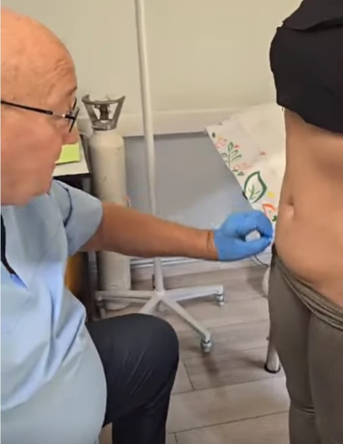 VIDEO. Noua metodă de remodelare corporală la Satu Mare: Lipoliza injectabilă la cabinet Dr. Coica